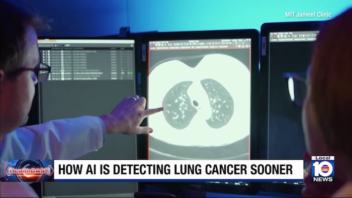 HealthCast: AI tool helps researchers assess patients' lung cancer risk