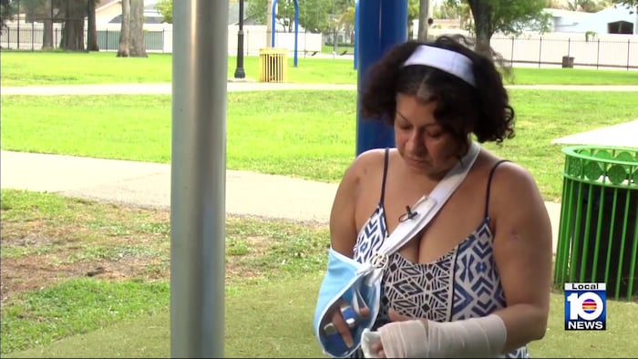 Coral Springs shooting survivor hopes to help others after alleged attack by ex-boyfriend
