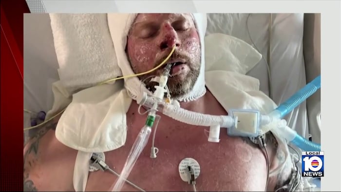 Couple in law enforcement recovers after surviving house fire in Florida Keys