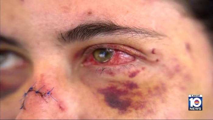 ‘I was fighting for my life': Woman describes homeless man's brutal attack in downtown Miami