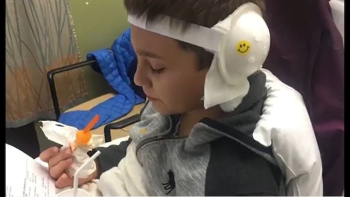 Children With Bilateral Cochlear Implants Show Emerging Spatial Hearing